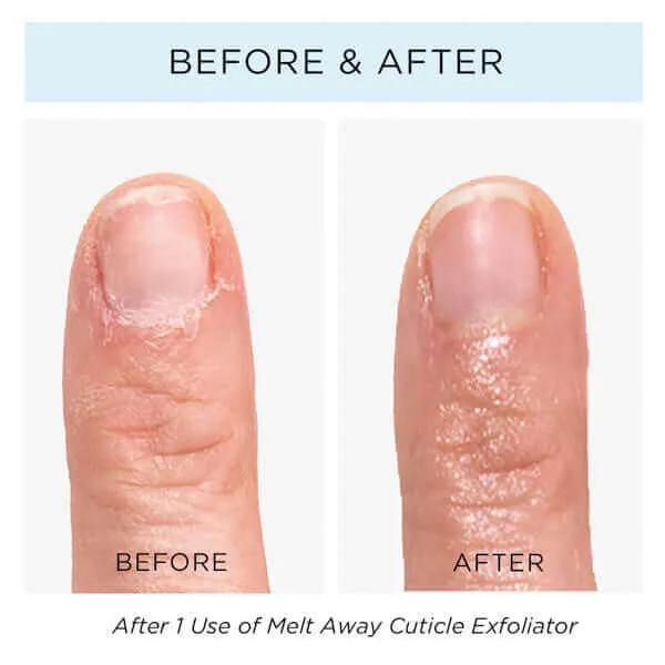 Melt Away Cuticle Exfoliator, 0.4 fl oz